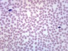 Human Blood Smear Wr Stain  Prepared Microscope Slide - 75x25mm - Eisco Labs