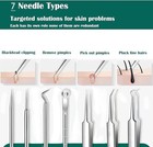 Acne Needle Blackhead Remover - Pimple   Comedone Extractor Tool Kit With Tweeze