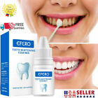 Teeth Cleaning Gel Efero Whitening Essence Serum Oral Hygiene Dental Care Serum