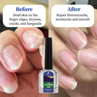 Nail Care Cuticle Oil  2-pack Fast Absorbing Repair Serum For Cracked Cuticles  