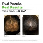 Avimee Herbal Keshpallav Hair Oil For Hair Growth   For Both Men   Women   Helps