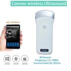 Wireless Ultrasound Convex Probe 3 5 5 Mhz 80 Element Scanner Portable Machine