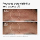 The Ordinary Niacinamide 10    Zinc 1  Smoothing Serum For Blemish-prone Skin