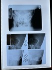 23 X-rays Human   Animal X-ray Films  Prop Teaching Silver  Xray 