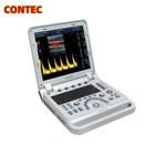 Contec Cms1700a-vet Color Doppler Portable Ultrasound Scanner Laptop Machine