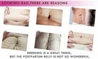 Crema Para Las Estrias Ideal Para Mujeres Embarazadas Luce Tu Piel Sin Miedo