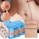 3x Silicone Scar Sheets  1 6 x 60  Roll   Silicone Scar Tape For Scar Removal Us