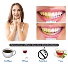 45  Peroxide Gel Teeth Whitening Whitener 10 Syringes Refill Dont Need Light Lot