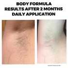 Hair Removal-permanent Hair Reduction-professionals Formula-face body 2 Oz