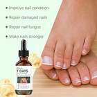 Ginger Nail-treatment Nail-care  Nail-growth Oil For Cuticle Nourishment Us