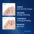 Tagrid Athlete   s Foot Treatment     Maximum Strength Antifungal Cream     3 5 Oz