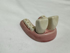 Vintage My Two Front Teeth  S p Salt Pepper Dental Medical Shakers Tooth