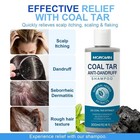 Coal Tar Dandruff Shampoo  2  Coal Tar Extract For Severe Dandruff  Psoriasis  
