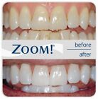 Zoom Chairside Whitening Gel Kit Hp  Light Activating