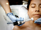 Procell Therapies Microchanning Pro Device Aesthetic Anti Aging Facial Treatment