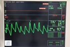 Ohmeda Modulus Cd Anesthesia Gas Machine
