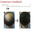 Powder Hair Loss 25 50  100g Care Thicken Refill Hair Building Fibers Sevich