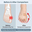 40 Pcs Pre-cut Bunion Corrector Kinesiology Tape    Elastic  Skin Color