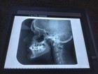 20 Human Skull X-rays Original Medical Weird Odd Photo