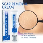 Scar Removal Cream Skin Repair Scar Remover Fade Stretch Mark Acne Treatment -  