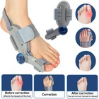Bunion Corrector Big Toe Splint Straightener Hallux Valgus Foot Separator Tool