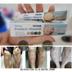 Psoriasis Ointment Skin Treatment 20g  x2  New In Box