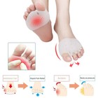 2pcs Silicone Bunion Toe Corrector Orthotics Straightener Separator Pain Foot