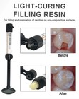 Dental Cement Resin Filling Materials Dentistry Denfil Syringe Universal Teeth