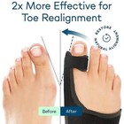 Bunion Corrector For Women   Men Big Toe Straightener Bunion Splints Correction