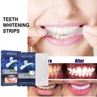 Professional Teeth Whitening Strips For Stain Removal And Bright White Smile