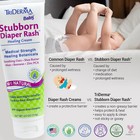 Triderma Md Baby Stubborn Diaper Rash Healing Cream   4 Ounces