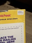 Myriad Sneak Peek Early Gender Test 99  Accurate Learn Gender At 6 Weeks New