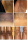 Aha Skin Lightening Cream Face   Body 15g Dark Skin Care Moisturizer