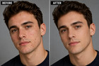 Professional Face Retouching Service Acne Pimple Removal Photo Editing