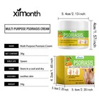 Skin Care Cre To Relieve Body Skin Itching Redn Pain