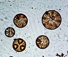 2 Antique  Microscope Slides   Diatoms Nitzschia And Actinoptychus By P j smith