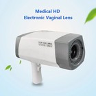 Digital Colposcope Hd Video Camera System For Gynecological Cervical Exam