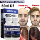 Extra Strength 5  Minoxidil Mens Liquid Hair Regrowth Treatment -6 Month Supply