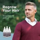 Minoxidil 5  Topical Solution For Men Hair Regrowth  Reactivates Hair Follicles