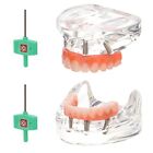 Dental Implant All-on-4 Overdenture Treatment Model Upper lower 4 Implants Clear