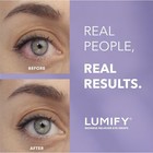 Bausch   Lomb Lumify Redness Reliever Eye Drops - 0 25fl Oz Exp 08 26