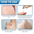 Professional Wart And Skin Tag Remover Cream Topical Skin Repair Treatments