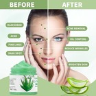 Aloe Vera Facial Scrub   Cleanser - Exfoliating Face Wash For Blackheads   Acne