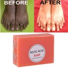 5 3x Kojic Acid Soap Dark Spot Whitening Bleaching Lightening Face   Body Skin