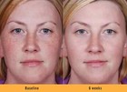 Kojic Acid Skin Whitening Lightening Ultra Brightening Serum Dark Spot Cream