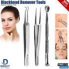 Blackhead Remover Tweezers Acne Pimple Blemish Comedone Extractor New Stainless