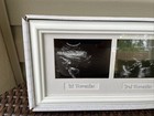 Triple Sonogram Frame Keepsake Ultrasound Picture Pregnancy Scan Images   Photos