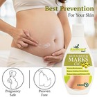 Ayumcure Stretch Mark Removal   Prevention Oil For Women 100ml