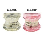 Dental Typodont Orthodontic Teeth Model With Metal Ceramic Brackets Retainer