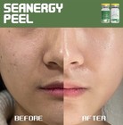 Stayve Seanergy Peel 